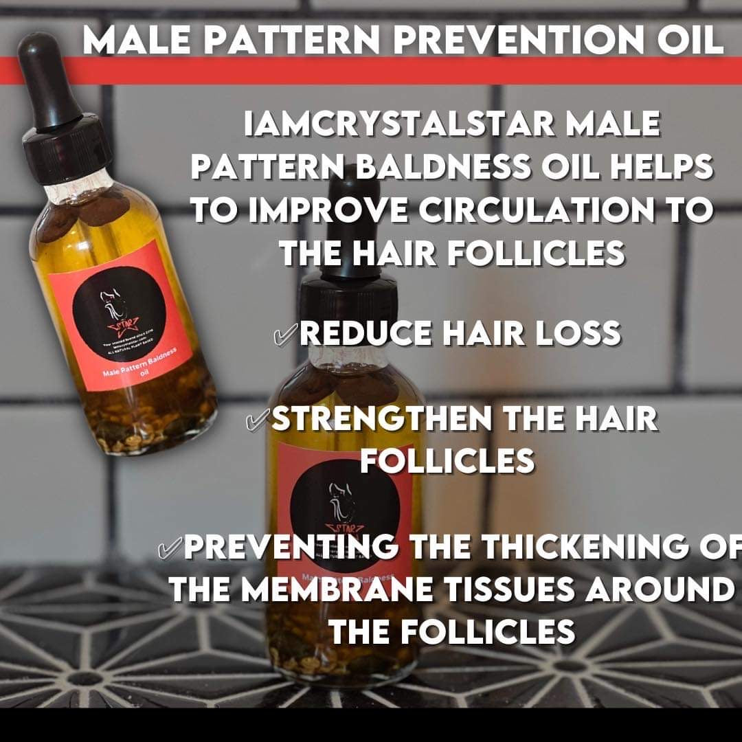 Wall Street Male Pattern Oil